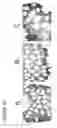 Fig. 19 - Method of reducing angiogenesis