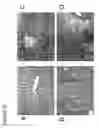 Fig. 28 - Method of reducing angiogenesis