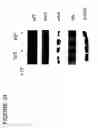 Fig. 35 - Method of reducing angiogenesis
