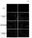 Fig. 06 - Methods of organ regeneration using -expressing pluripotent cells