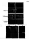 Fig. 07 - Methods of organ regeneration using -expressing pluripotent cells