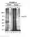 Fig. 01 - Methods for diagnosing and treating autoimmune disease