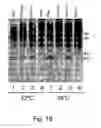 Fig. 52 - Multi plasmid system for the production of influenza virus