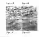 Fig. 15 - Prophylactic and therapeutic immunization against protozoan infection and disease