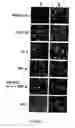 Fig. 05 - Pine cone extracts and uses thereof