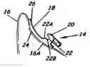 Fig. 01 - Modular system for customized orthodontic appliances