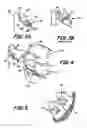 Fig. 03 - Modular system for customized orthodontic appliances