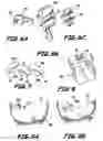Fig. 04 - Modular system for customized orthodontic appliances