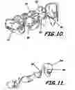 Fig. 05 - Modular system for customized orthodontic appliances