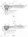 Fig. 05 - Combination rotating dental cleaning brush and paste device