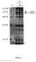 Fig. 101 - Nucleic acid detection kits