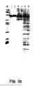 Fig. 47 - Nucleic acid detection kits