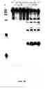 Fig. 97 - Nucleic acid detection kits