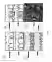 Fig. 02 - Diagnostic and therapeutic uses of SUFU gene