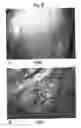 Fig. 10 - Compositions and methods for detection and treatment of proliferative abnormalities associated with overexpression of human transketolase like-1 gene