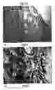 Fig. 12 - Compositions and methods for detection and treatment of proliferative abnormalities associated with overexpression of human transketolase like-1 gene