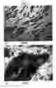 Fig. 13 - Compositions and methods for detection and treatment of proliferative abnormalities associated with overexpression of human transketolase like-1 gene