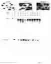 Fig. 06 - Detection of methylated CpG rich sequences diagnostic for malignant cells