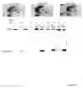 Fig. 07 - Detection of methylated CpG rich sequences diagnostic for malignant cells