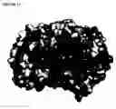 Fig. 75 - Novel purified polypeptides from Streptococcus pneumoniae