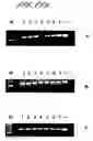 Fig. 49 - Tumour associated antigens