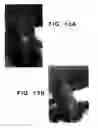 Fig. 26 - Drosophila recombination-associated protein and methods of use