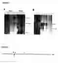 Fig. 04 - Nucleic acid molecules comprising the promoter for PCA3, and uses thereof