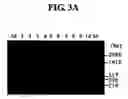 Fig. 04 - Diagnostic method for cancer characterized in the detection of the deletion of G-CSF exon 3
