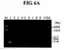 Fig. 08 - Diagnostic method for cancer characterized in the detection of the deletion of G-CSF exon 3