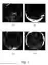 Fig. 02 - Methods for culturing human embryonic stem cells