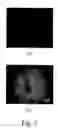 Fig. 04 - Methods for culturing human embryonic stem cells