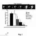 Fig. 04 - Growth factor therapy mobilization of stem cells into the peripheral blood