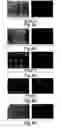 Fig. 10 - Cell patterning technique