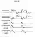 Fig. 06 - Plasma display panel aging method and aging device