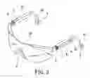 Fig. 04 - Wireless communication glasses