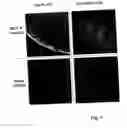 Fig. 08 - Use of monocarboxylate transporter protein for thyroid hormone transport
