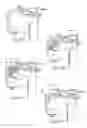 Fig. 15 - Devices, systems, and methods to fixate tissue within the regions of body, such as the pharyngeal conduit