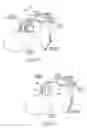 Fig. 18 - Devices, systems, and methods to fixate tissue within the regions of body, such as the pharyngeal conduit