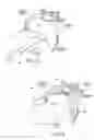 Fig. 21 - Devices, systems, and methods to fixate tissue within the regions of body, such as the pharyngeal conduit