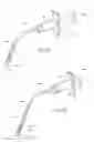 Fig. 22 - Devices, systems, and methods to fixate tissue within the regions of body, such as the pharyngeal conduit