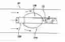 Fig. 01 - Cerebral perfusion augmentation