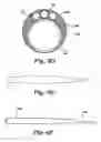 Fig. 10 - Cerebral perfusion augmentation