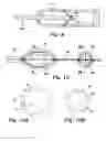 Fig. 13 - Cerebral perfusion augmentation