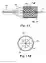 Fig. 14 - Cerebral perfusion augmentation