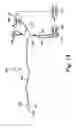 Fig. 17 - Cerebral perfusion augmentation