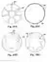 Fig. 24 - Cerebral perfusion augmentation
