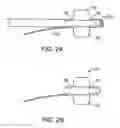 Fig. 03 - Balloon catheter sheath