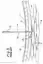 Fig. 06 - Surgical access apparatus and method