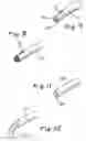 Fig. 09 - Surgical access apparatus and method
