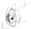 Fig. 06 - Surface plasmon resonance based nanoliter tear osmometer